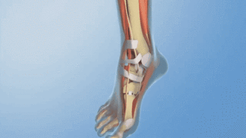 0a556b470a99fb5c078aed8f8a3f6449.gif
