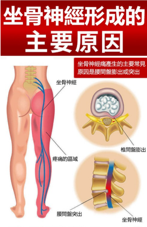 5b188b7554518a8d002720abc407be99.png