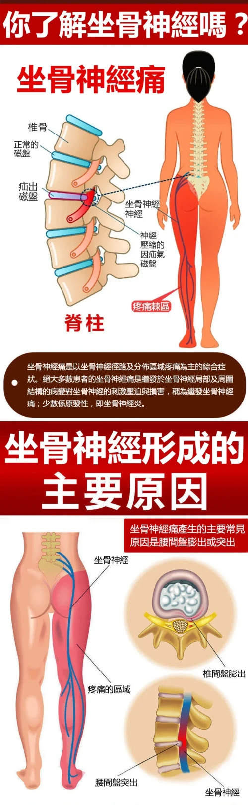 9e2967aa681be6ee7c3282474655caf9.webp