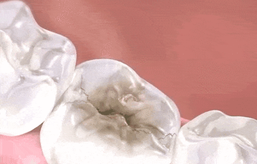 9fe7b11e58052281b6aeb2a8bd3a1a00.gif