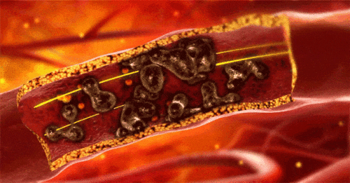 921ea31a129a604cbeafc83cd0d56f58.gif
