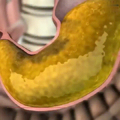 a40d334756ac9a8a4dffabfdfff0c737.gif