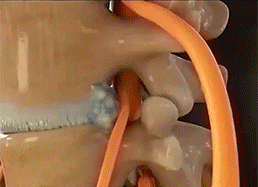 d24b3d26fa23aae95d6d2a8bdf5b7076.gif