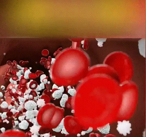 bb45dbf97ae8f4f9dc307bf0e5d5dbf0.gif