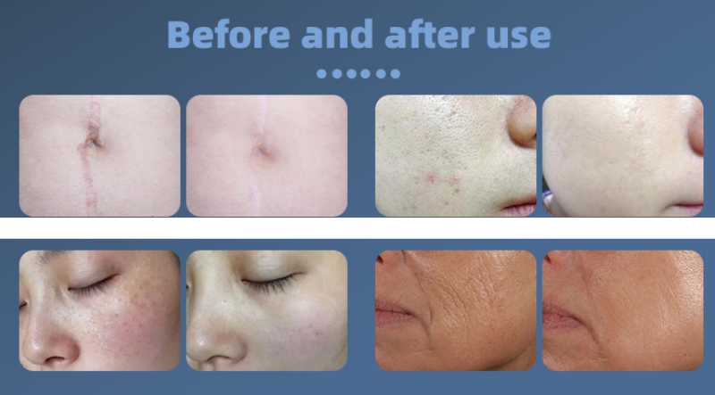 ???? 20240926193046 ??