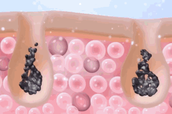 0fba6354992fdd71302fad8d38f07525.gif